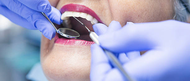 Best Dental Abscess Treatment in West Rancho Dominguez, CA